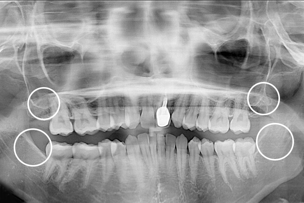 PX20210303_194755_0829_00000000.jpg