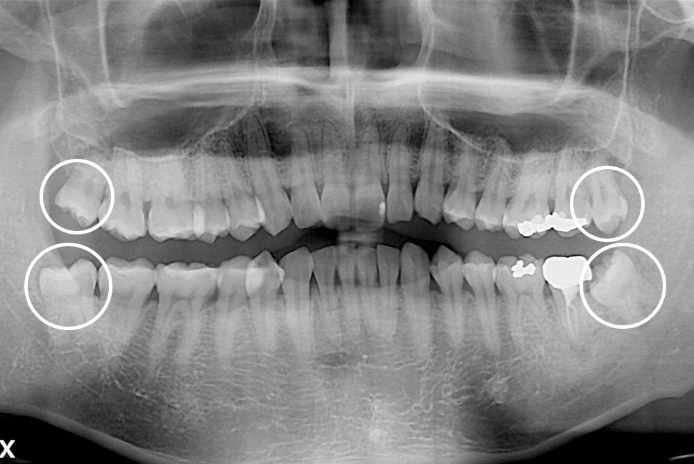 16ac1de11070be46cff9afd890704ba2.jpg