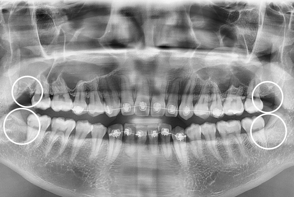 PX20211007_181619_0000_00004C5E.jpg