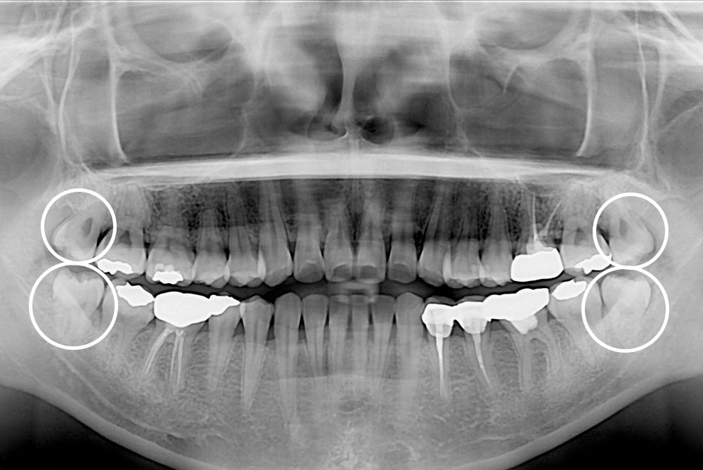 1344bd03104bf4e609d7bcc108fbc9e3.jpg