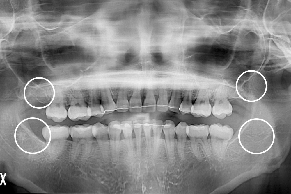 PX20210308_150454_0190_00000000.jpg