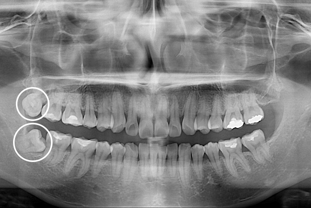 cae37a4067be4c2a679cd2cf2a3ada0c.jpg