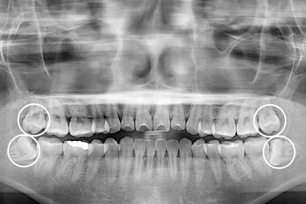 ddf101b55ffa52f8594e015abea9219d.jpg