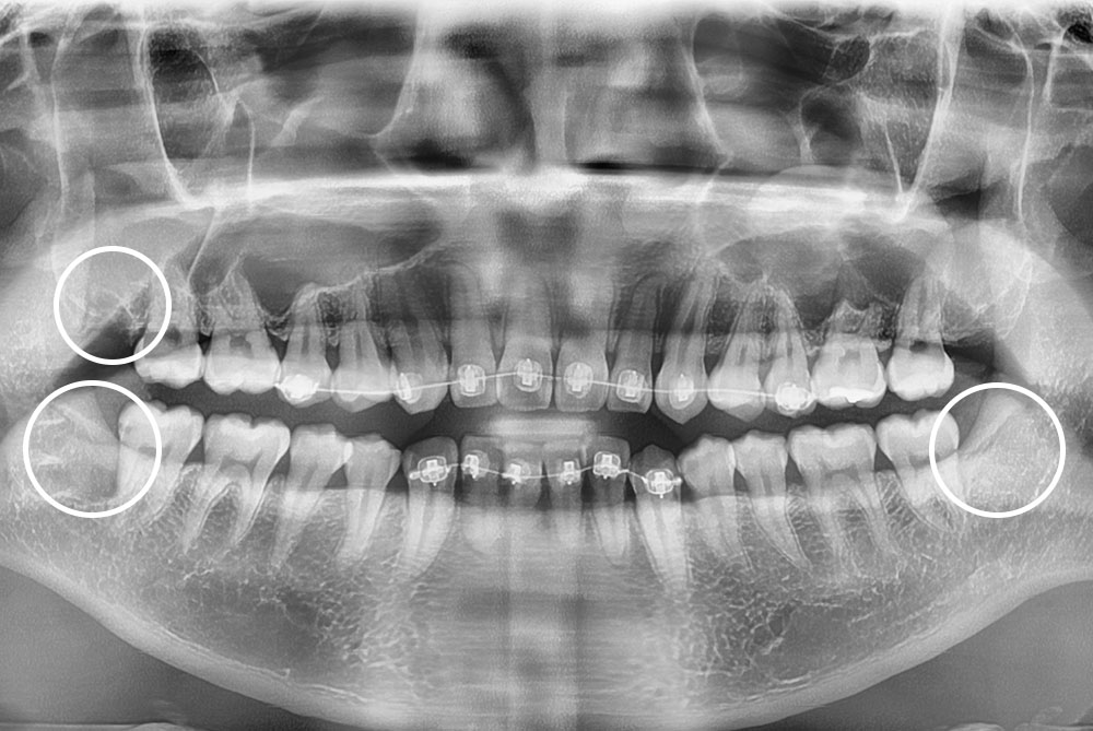 PX20211007_181619_0000_00004C5E.jpg
